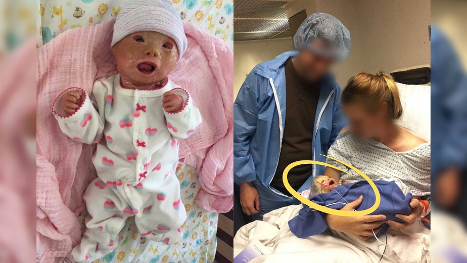 Parents see baby's face right after birth and their mood completely